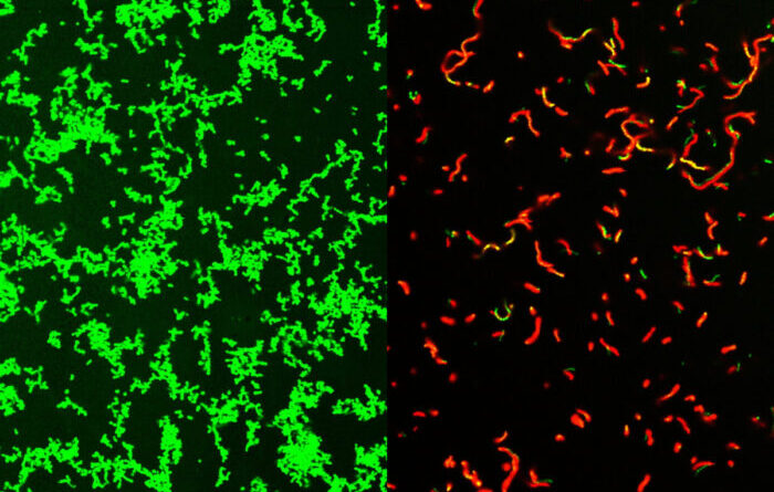 A microscopic image of untreated live Streptococcus pyogenes in culture is green and cultured dead bacteria are red.