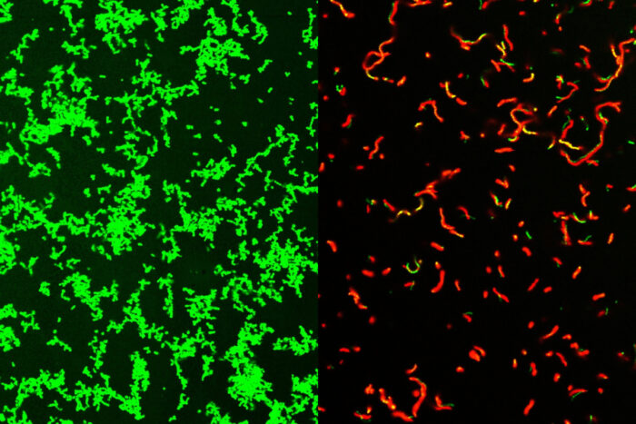 A microscopic image of untreated live Streptococcus pyogenes in culture is green and cultured dead bacteria are red.